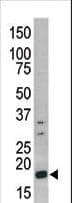 HIST1H3A Antibody (phospho-Ser10)