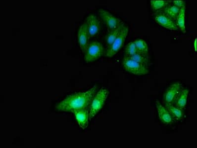 Polyclonal Rabbit anti-Human KIDINS220 / ARMS Antibody (IHC, IF, WB)
