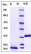 Human TGFB1 / TGF Beta 1 Protein (Recombinant)