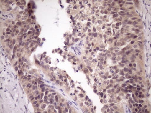 Monoclonal Mouse anti-Human ZNF449 Antibody (clone OTI4C6, IHC, WB)