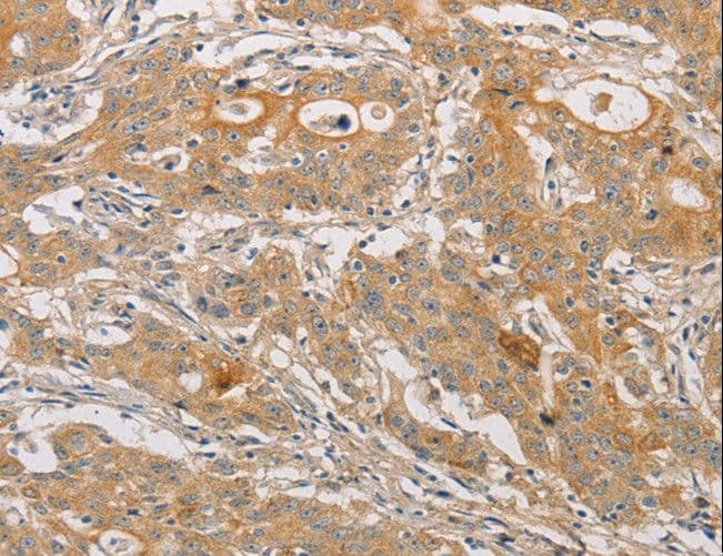 Polyclonal Rabbit anti-Human ARSK / Arylsulfatase K Antibody (IHC)