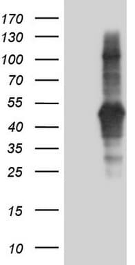 Monoclonal Mouse anti-Human TACC2 Antibody (clone OTI7F12, aa727-1026, WB)