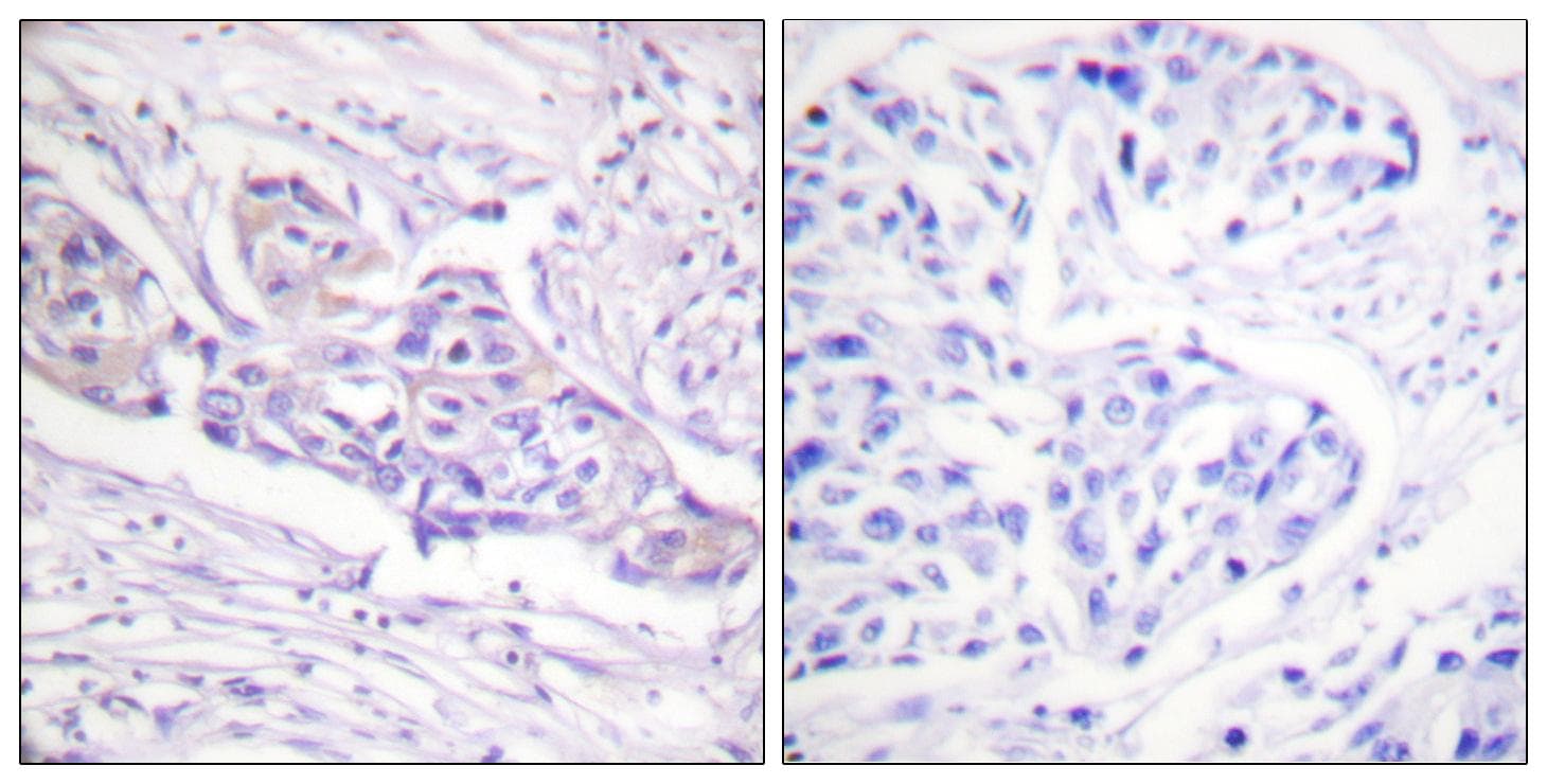 FOXO1 / FKHR Antibody (phospho-Ser329)