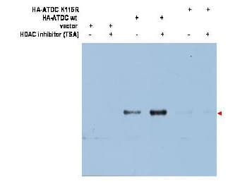 TRIM29 Antibody (Lys116, Internal)