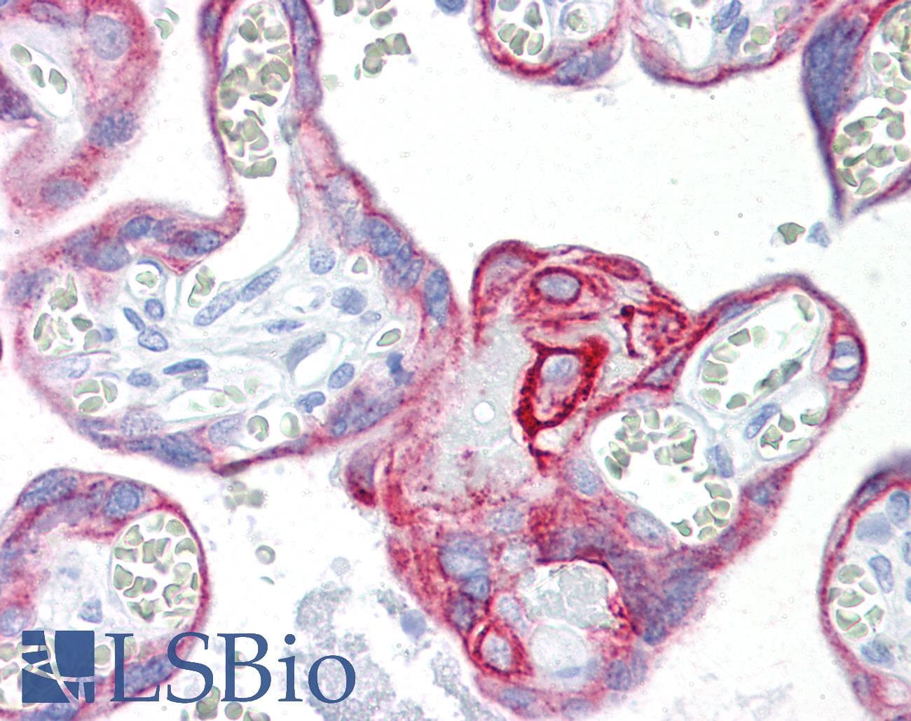 IHC-plus™ KRT7 / CK7 / Cytokeratin 7 Antibody (clone RCK105)