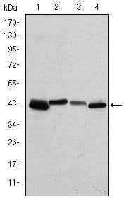 KRT19 / CK19 / Cytokeratin 19 Antibody (clone 400000000)