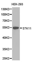 STK11 / LKB1 Antibody