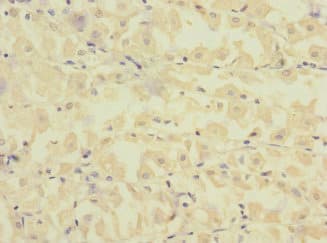 FCRL2 / IRTA4 Antibody