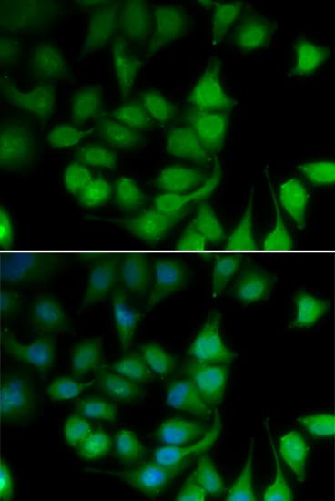 Polyclonal Rabbit anti-Human POLR2H / RPB8 Antibody (IHC, IF, WB)