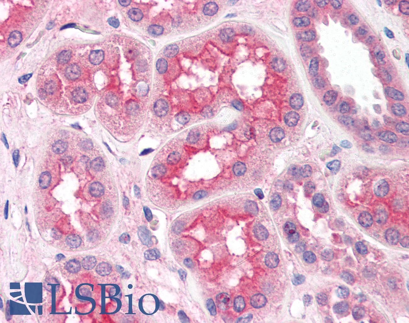 IHC-plus™ SLC5A1 / SGLT1 Antibody