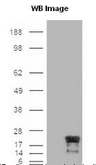 BIRC5 / Survivin Antibody (aa57-67, clone 60.11, DY488)