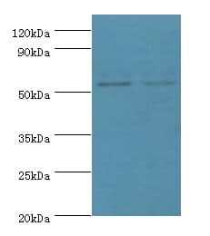 MATN3 / Matrilin 3 Antibody (aa277-486)