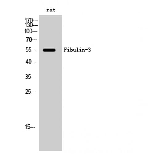 Polyclonal Rabbit anti-Human Fibulin-3 / EFEMP1 Antibody (80-160 aa, Internal, IHC, WB)