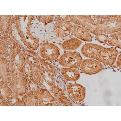 MAPT / Tau Antibody (phospho-Ser262)
