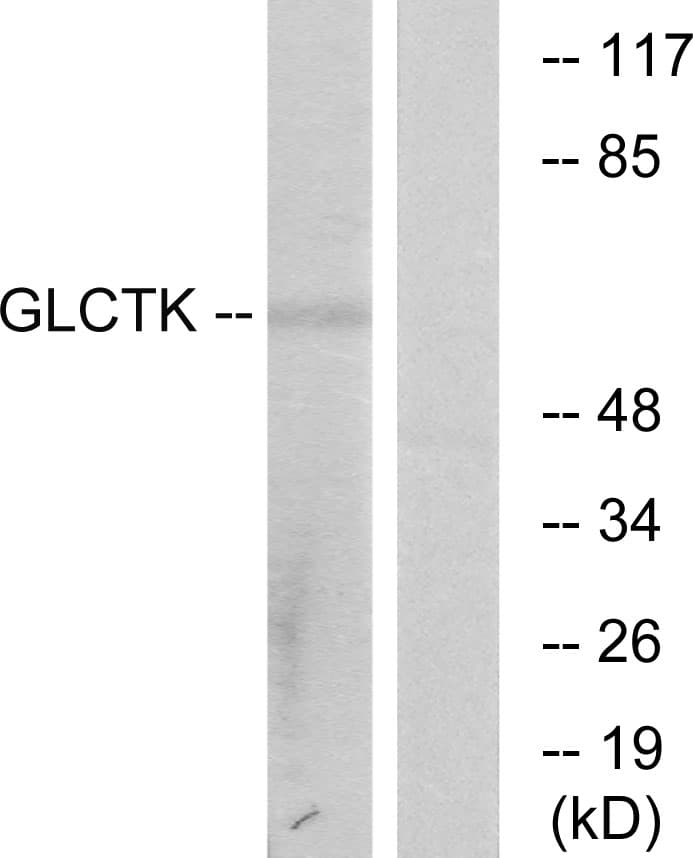 Polyclonal Rabbit anti-Human GLYCTK / Glycerate Kinase Antibody (aa101-150, IHC, IF, WB)