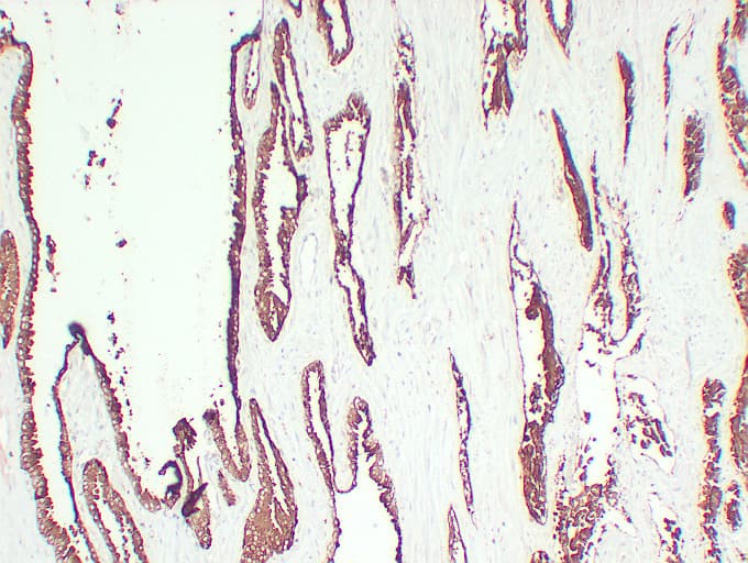 Monoclonal Mouse anti-Human ACPP / PAP Antibody (clone ABT-PSAP, IHC)