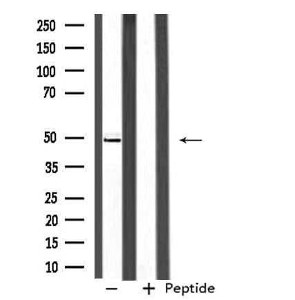 SEPT6 / Septin 6 Antibody