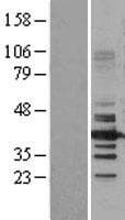 HDAC11 Protein (Over-Expression Lysate Myc-DDK (Flag))