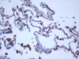 Monoclonal Mouse anti-Human DDX59 Antibody (clone OTI2G1, IHC, WB)