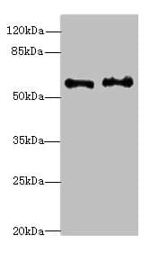Polyclonal Rabbit anti-Human NMT2 Antibody (IHC, WB)