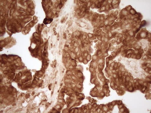 GRN / Granulin Antibody (aa327-593, clone OTI1F9)