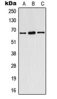 ER Alpha / Estrogen Receptor Antibody (phospho-Tyr537)