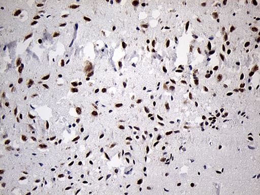 DLX1 Antibody (aa1-255, clone OTI1E6)