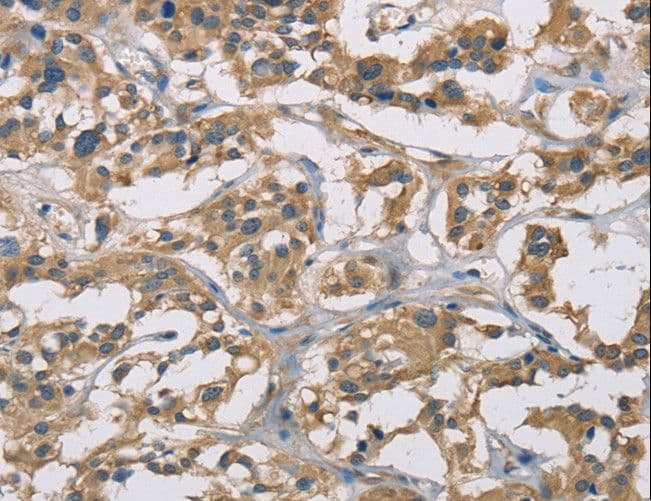 CYR61 Antibody