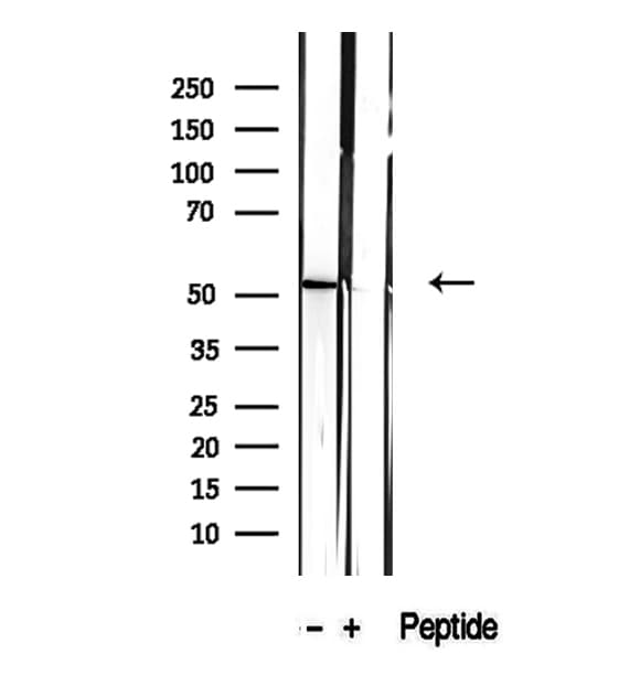 Polyclonal Rabbit anti-Human CALCOCO2 Antibody (IHC, IF, WB)