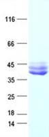 Human IL12B / IL12 p40 Protein (Recombinant DDK,C-terminus)