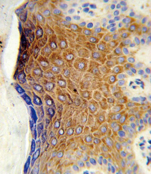 GALNT3 Antibody (aa454-481)