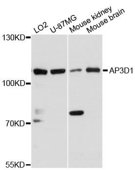 AP3D1 / Adaptin Delta Antibody