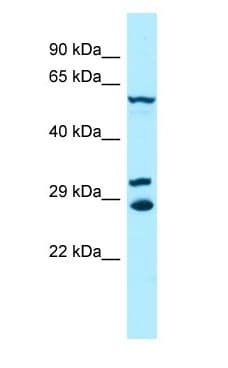 DYRK2 Antibody (aa434-483)