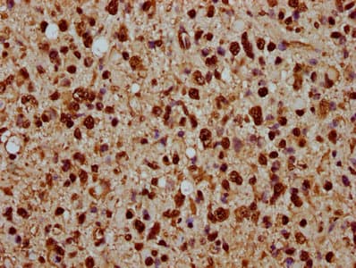 HIST1H1C Antibody