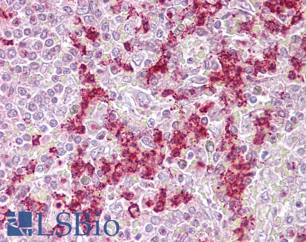 ZNF307 Antibody (aa38-87)