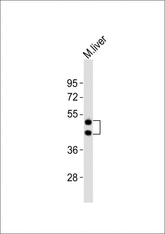 HPN / TMPRSS1 / Hepsin Antibody (aa153-188)