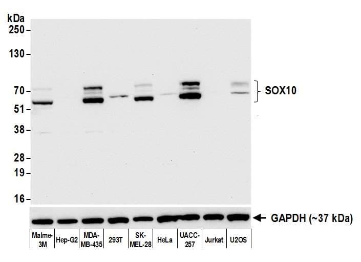 SOX10 Antibody (aa416-466)