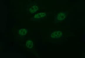 Monoclonal Mouse anti-Human CD163 Antibody (clone 2C7, IHC, IF, WB)