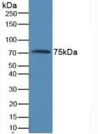 AMH / Anti-Mullerian Hormone Antibody