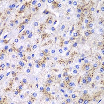 CTSD / Cathepsin D Antibody