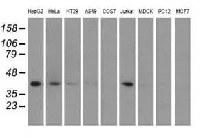 HIBCH Antibody (clone OTI3F6)