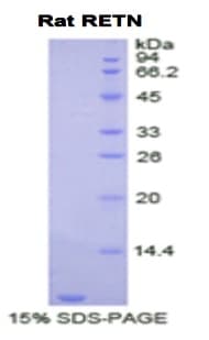 Rat RETN / Resistin Protein (Recombinant His)