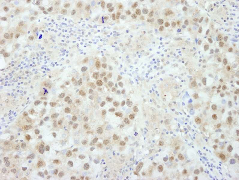 BRCA1 Antibody (aa700-750)