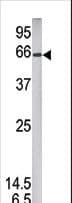 STAT1 Antibody (phospho-Ser727)