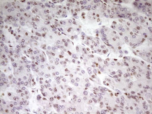 Monoclonal Mouse anti-Human SP110 Antibody (clone OTI4C1, aa232-521, IHC, WB)