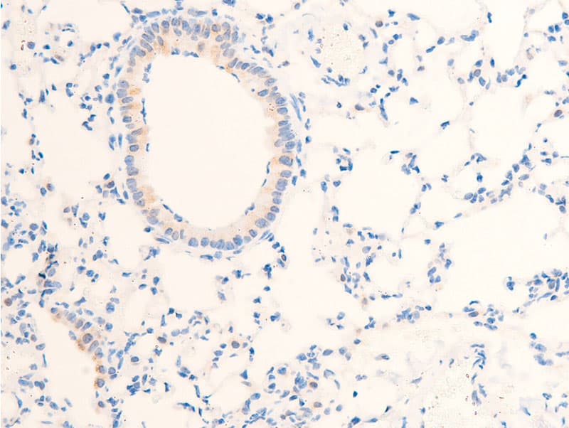 EGFR Antibody (phospho-Ser1071)