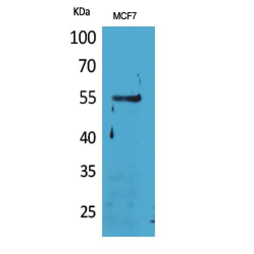Polyclonal Rabbit anti-Human LILRA4 / ILT7 Antibody (391-440 aa, Internal, WB)