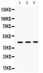 Polyclonal Rabbit anti-Human ORM1 / Orosomucoid Antibody (IHC, WB)