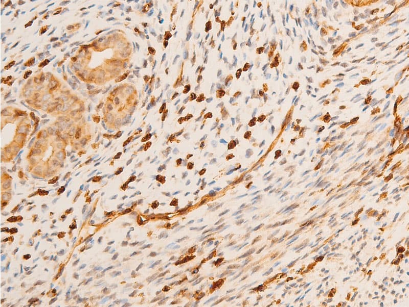 TP73 / p73 Antibody (phospho-Tyr99)