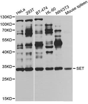 SET / TAF-I Antibody